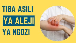 Tiba asili ya Allergy ya Ngozi (mzio): Tumia dawa hii ya asili kama uasumbuliwa na aleji ya ngozi