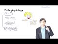 steroid induced psychosis all you need to know explained in detail by dr.pramil cheriyath md