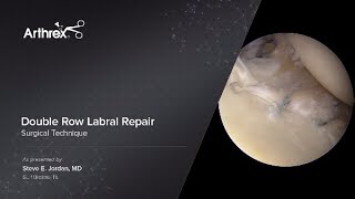 Double Row Labral Repair