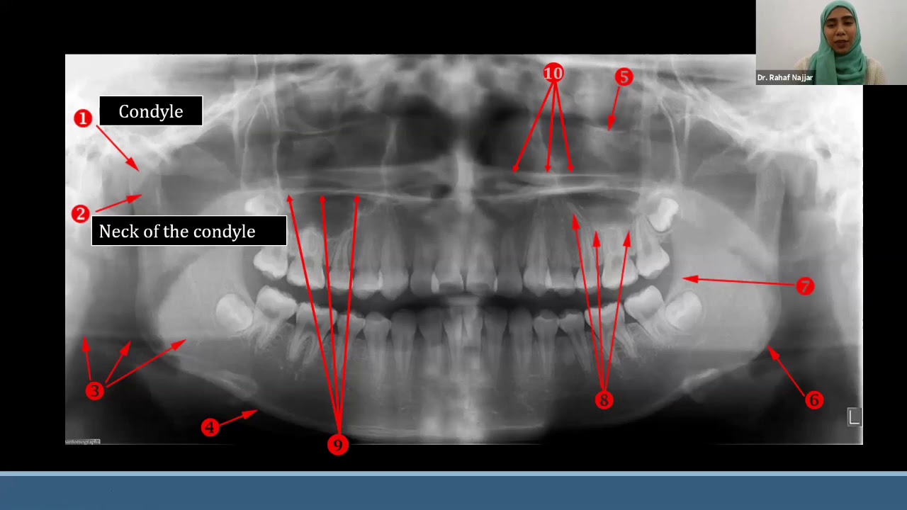 Interpretation Of Panoramic Radiography With Interactive Cases - YouTube