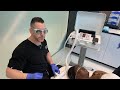 Aerolase Laser | West Hollywood, CA | Dr. Jason Emer