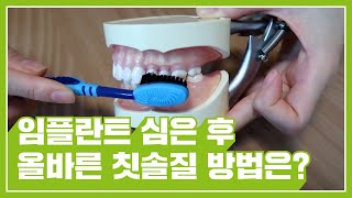 [스트라우만x한입언니] 2편. 임플란트 심은 후 올바른 칫솔질 방법은?