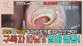 (ENG SUB)엄마의 발톱관리! 구독자 따님께서 엄마 모시고 오셨어요~ 효도와 직관 두마리 토끼를 잡다! ingrown toenail - Fresh Foot 풋풋한리쌤 성수점
