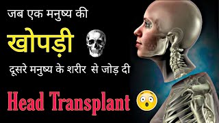 जब एक मनुष्य की खोपड़ी को दूसरे मनुष्य के शरीर से जोड़ दिया।। Head Transplant / Brain Transplant