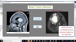 Brain tumor segmentation from MRI CT images - matlab projects code
