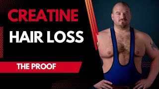 Creatine & Hair Loss: The Proof