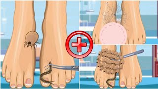 ASMR removes brown ticks & worms infected hand | How to remove dog ticks ASMR 2D ANIMATION