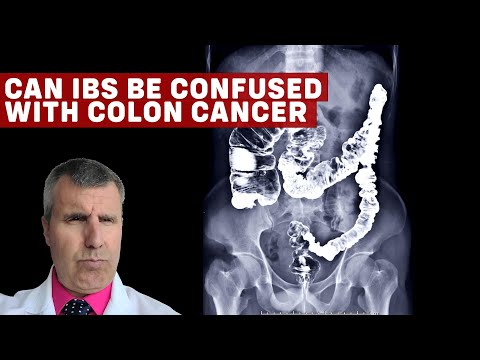 Does IBS increase risk of cancer?