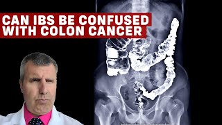 IBS vs. Colon Cancer: Understanding the Differences and Similarities