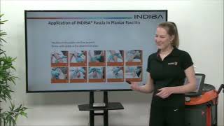 EN9 INDIBA ACTIV    INDIBA FASCIA   Treatment of plantar fasciitis