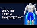 Life After Radical Prostatectomy