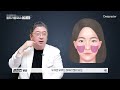 눈밑 울트라콜 시술 후 부작용이 발생하는 이유│울트라콜qna 모음집【3편】 reasons for ultracol side effects