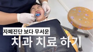 자폐 아이의 치과 치료 [ 12개 한 번에 치료하기]