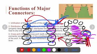 3-06 prosthodontics, Maxillary major connectors.