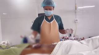 লিঙ্গ বড় করার পর রোগীর অনুভূতি | Penile enlargement surgery in Bangladesh