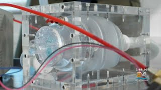 Engineers Go Back To Basics To Solve Ventilator Shortage During Coronavirus Pandemic