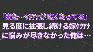 【修羅場】俺「まただ…ケ〇アナが広くなってる」見る度に拡張し続ける嫁ケ〇アナに悩みが尽きなかった俺は…【スカッとする話】