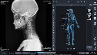 Digital X-ray Software Demo