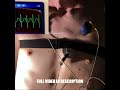 Heart failing to beat and freaking out🫀#boy  #visible  #heart  #heartbeat  #ecg  #skinny  #shirtless