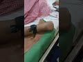 #doctor #trending #shortvideo #medical #iv# cannula #viral #🧿👌❤️#life