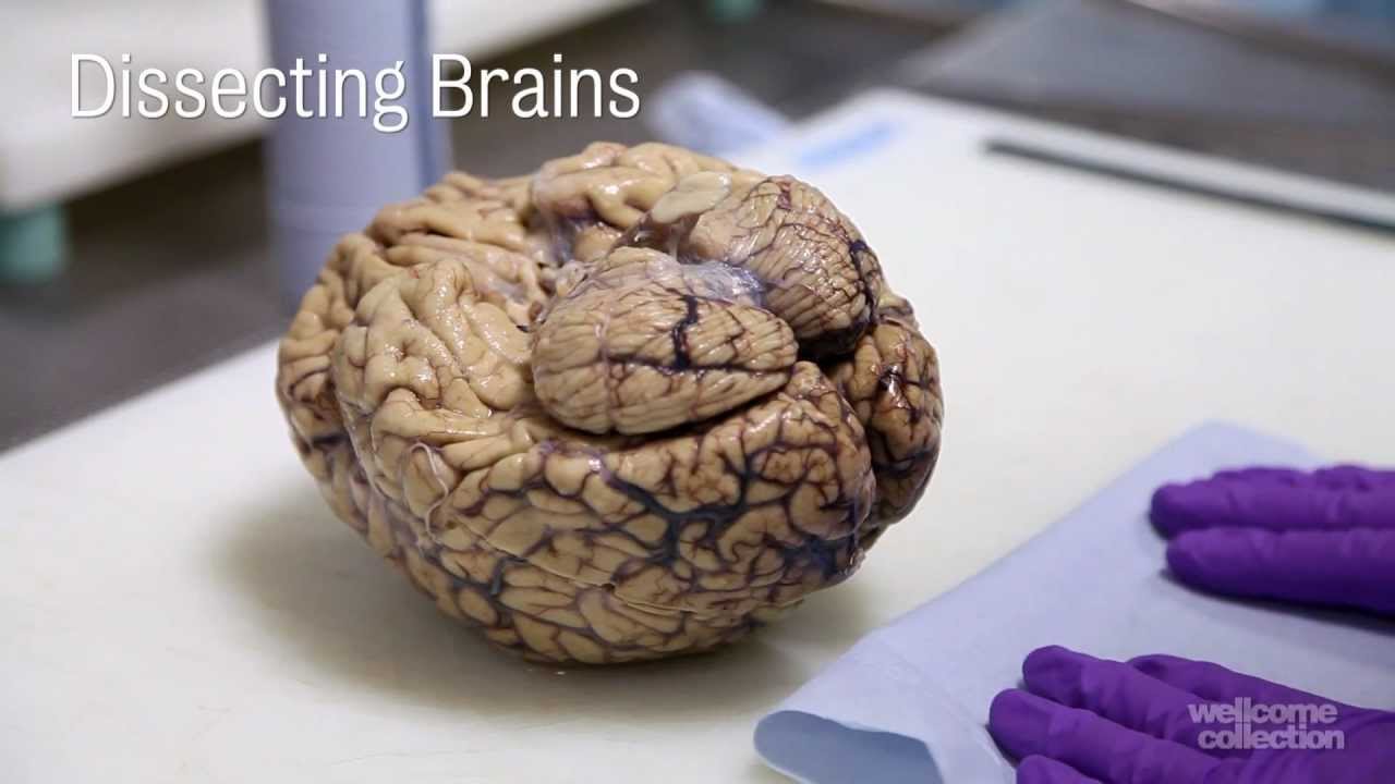 Inside Human Brain
