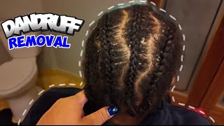 Dandruff Scratching Removal + Mini Vlog to the Beauty Supply Store!