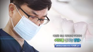 치아를 살리는 방법 - 경북대치과병원 치주과 이재목 교수 - 2