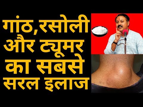 शरीर के किसी भी हिस्से में गांठ, रसोली और ट्यूमर का सबसे सरल इलाज | lump,rasoli & tumor | RajivDixit शरीर के किसी भी हिस्से में गांठ, रसोली और ट्यूमर का सबसे सरल इलाज | lump,rasoli & tumor | RajivDixit