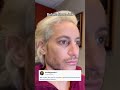 frankiegrande reveals his new nose after undergoing surgery. 🎥 tt shorts