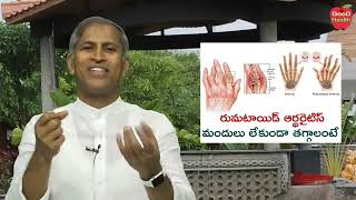 రుమటాయిడ్ ఆర్థరైటిస్ మందులు లేకుండా తగ్గాలంటే |Rheumatoid Arthritis | Dr Manthena Satyanarayana raju