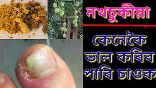 নখচুকীয়া হলে এইকেইটা দৰব মাত্ৰ ৩ দিন লগাওক, চাওক কেনেকৈ আপোনাৰ নখ সুন্দৰ আৰু নতুন হৈ পৰিছে||