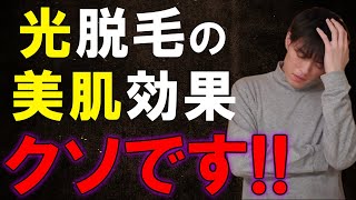 光脱毛の美肌効果がクソだと思う理由を正直に話します。