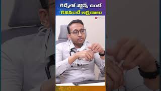 కిడ్నీలో స్టోన్స్ ఉంటే కనిపించే లక్షణాలు | #shorts #ytshorts #health #kidney #healthylifestyle #tips