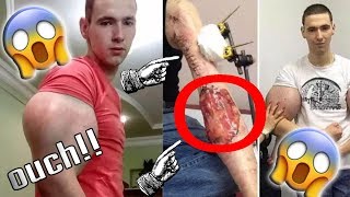 "Synthol Kid" Nearly Loses His Arms!!! - Synthol Kid - Russian Bodybuilder - Bodybuilder