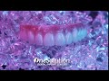 OneSolution® Dental Implant Centers - Zirconia Prosthesis