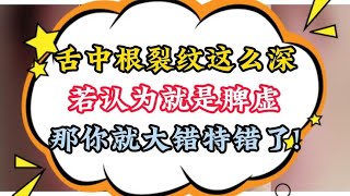 舌中根裂纹这么深，若认为就是脾虚，那你就大错特错了!