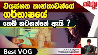 කාන්තාවන්ගේ ගර්භාෂයයේ ගෙඩිවර්ග හටගන්නේ ඇයි ? | MY VOG | Health Tips | Kadulla TV