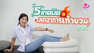 5 เทคนิคลดอาการเท้าบวมแบบง่ายๆ | 5 นาทีดีต่อสุภาพ EP. 42