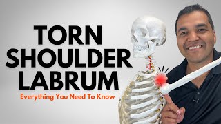 Torn Shoulder Labrum: Everything You Need To Know [Diagnosis & Treatment]