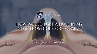 How would I get a hole in my nose from coke or cocaine?