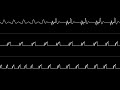 jammer “al risah” c64 oscilloscope view