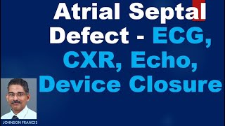 Atrial Septal Defect - ECG, CXR, Echo, Device Closure