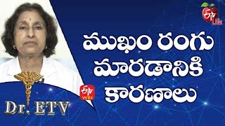 Causes Of Skin Discoloration | ముఖం రంగు మారడానికి కారణాలు  | Dr.ETV | 8th Aug 2022 | ETV Life