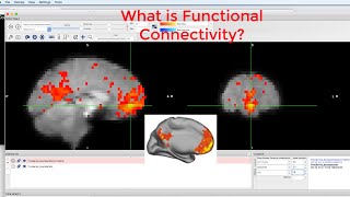 CONN Tutorial #1: What is Functional Connectivity?