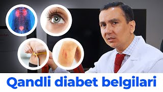 Qandli diabet Belgilari!