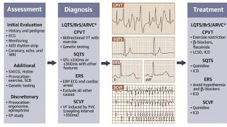 Sudden Cardiac Death: Prediction, ECG Quiz Prevention Insights, Management