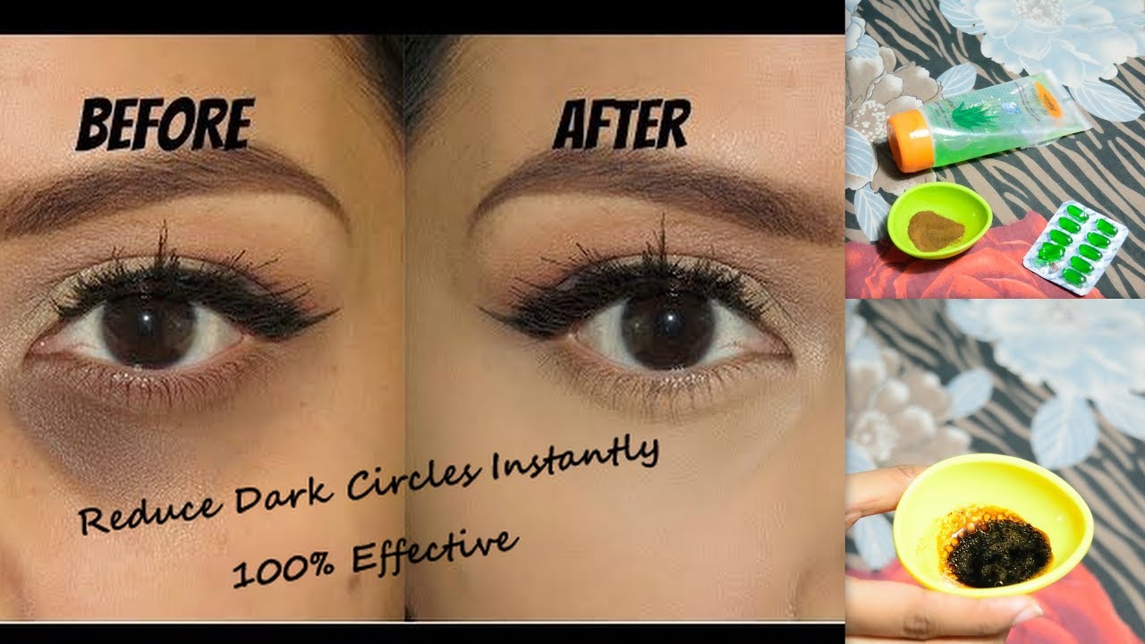 Under Eye Mask For Dark Circles Diy At Bill Henson Blog