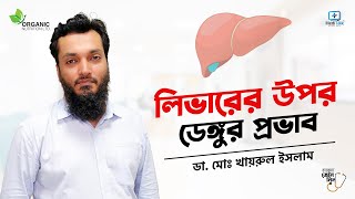 ডেঙ্গু যেভাবে লিভারের সমস্যা করে