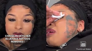 Chrisean Rock Breaks Down Crying After Starting The Process To Get All Her Blueface Tattoos Removed!