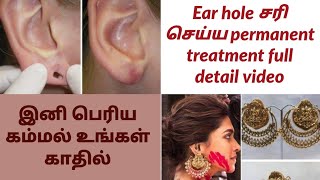 No problem easy solution இனி பெரிய கம்மல் உங்கள் காதில்/ear lobe permanent treatment full detail...